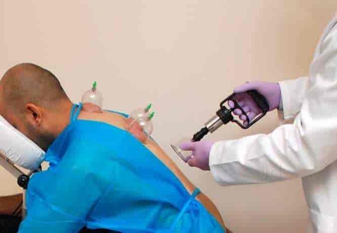 3 Best Hijama Center In Faisalabad