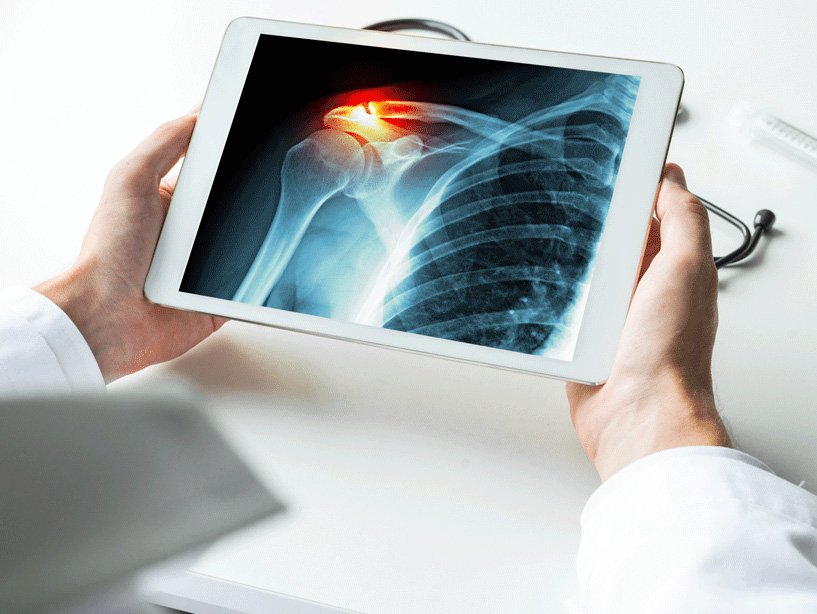 5 Best X-Ray in Islamabad