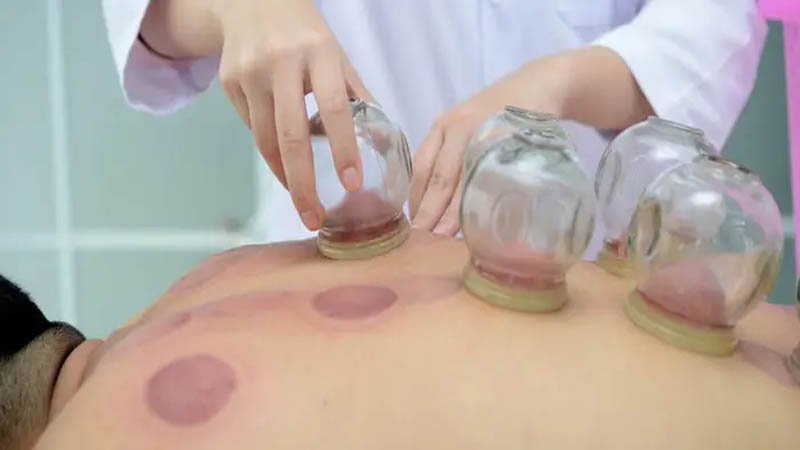 5 Best Hijama Center in Quetta